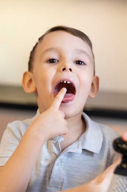 Язвы на языке у ребенка: эффективные методы лечения