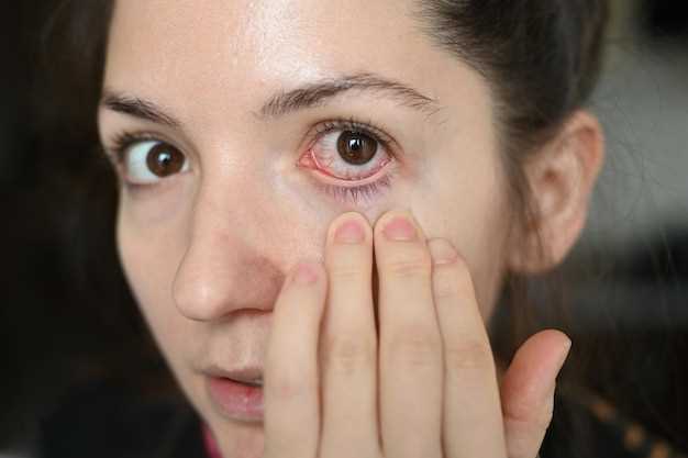 Эффективные методы лечения ячменя на глазу